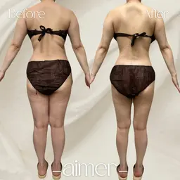 [ミニモ学割]U24限定‪‪❤︎‬全身‪‪❤︎‬ハイパーナイフ90分