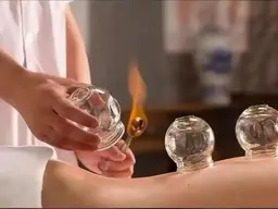 火ピング(背中経絡付)(20分)