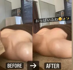 バザルトストーンスペシャル小顔コース（ハイパーナイフ10分付き）