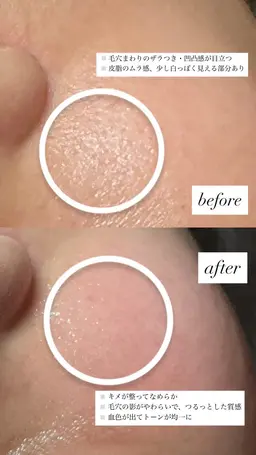 《マシュマロ肌ケア》赤み、乾燥、敏感肌 ¥8,800 → ¥3,500ハイドロ毛穴洗浄＋ヒト幹細胞＋特殊パック