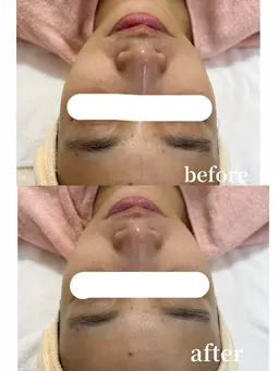 ディープクレンジング60分💆🏼‍♀️🫧【お仕上げメイク付き💄】