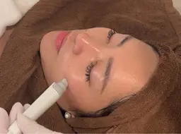 🔆3500円で毛穴スッキリ🔆ハイドラ毛穴洗浄🫧