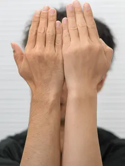 男性腕まるごと脱毛メンズ