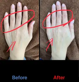 【🤚年齢が出やすい手✋】シワやたるみ気になっていませんか？？指脱毛＋ハンドエステで若々しい手に✨　　ハンドパック付き