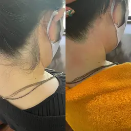 《☆施術時間10分☆》　　　　　　　　　　　　　　　　　　　　　　　　　　うなじwax脱毛