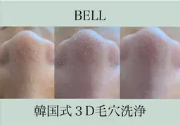 練習モデル【韓国式3D毛穴洗浄×高濃度ビタミンC】相性抜群の組み合わせ🍋毛穴の引き締め効果をUP⤴️通常27400円！