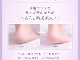足裏角質ケア♪専用マシーンでツルツルかかとに♪フットバス、保湿ケア付き!