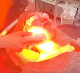 月1回の美容習慣⭐︎光フォト美容で肌メンテナンス