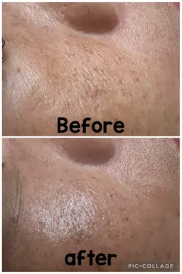 毛穴洗浄、ハンドエステ、パック