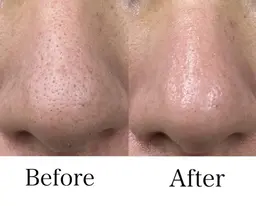 【ご新規様＊肌ケア】頭蓋骨小顔矯正＋選べる肌ケア　通常16,000円→ミニモ限定初回10,700円