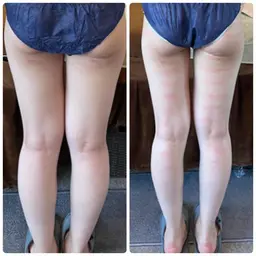 選べる【本気の上半身or下半身コース‼️お試し】背中・お腹・腕or脚・ヒップ✨美容整体付き痩身スリムボディ