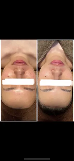 フェイシャル.デコルテマッサージ（エイジングケア込み）🌿