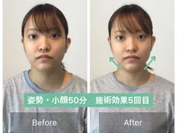 【歪み改善人気No.1】顔の歪み左右差&小顔矯正+姿勢矯正【50分17900→0】※先着3名