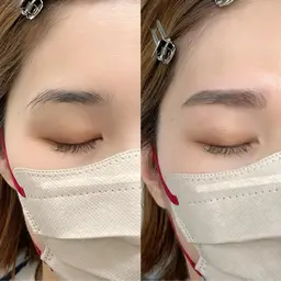 【当店人気No.1🌿】美眉スタイリング+額orフェイスラインワックス脱毛✨