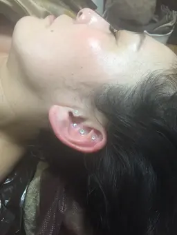 ダイエット耳つぼジュエリー             チタンシート両耳で8ツボ