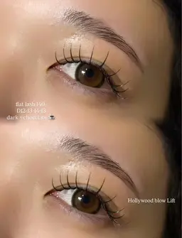 ハリウッドブロウリフト