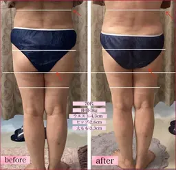 【無料カウンセリング0円】エステで効果が不安な方。初めてエステの方。メニューでお悩みの方へ🌝