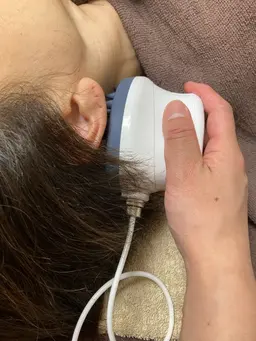 エクソソーム頭皮ケア