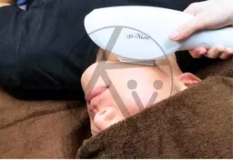 男性用/ハイパワーヒゲ脱毛[クレンジング洗顔整肌付き]/メンズ脱毛