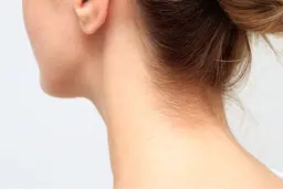 レディース襟足シェービング&脱毛!