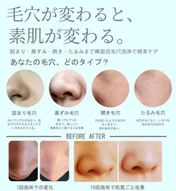 韓国式🇰🇷毛穴洗浄✨✨鏡を見る度に気になる毛穴、、、毛穴洗浄で綺麗サッパリ毛穴のお悩みとおさらばしてみませんか？