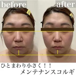 ✨🌷リフトアップ小顔マッサージ🌷✨【小顔コルギ＋ボディコルギ　60分】たるみ/ほうれい線/肩こり/首こり/肩甲骨