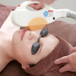 人気No. 1☆まるごとお顔脱毛　透明感UPで化粧ノリ抜群