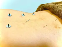 【酸素カプセル無料付 全身コース】はりきゅうマッサージ　痛みや冷え不眠改善。不調を取り除きリラックスしたい方にオススメ！