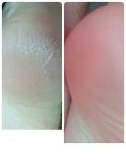 足裏ぷるぷるケア