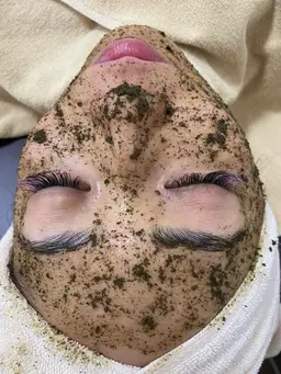 最強の肌改善🌿肌質改善🔥医療レベルの効果大🔥【剥離ありorなしオーダーメイドでお肌に合った選択】ハーブピーリング!