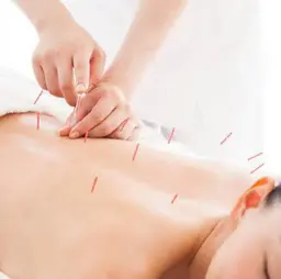 🍄限定メニュー🍄全身鍼　メンズも対応可