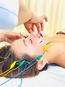 ✨人気No.４✨【電気美容鍼＋頭蓋骨矯正(頭皮スパ)】他で変化を感じれなかった方！本格最強変化👍