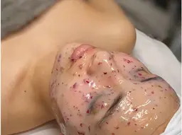 女性　フェイスシュガーリング+ハイドロジェリーマスク