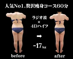 ◎結果重視で成功者続出サロン★【お腹・背中・二の腕】オーダーメイド痩身★上半身集中痩せ60分　2980円