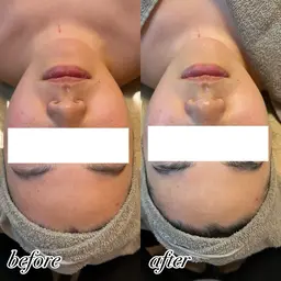 新‼️うるつや美肌コース✨