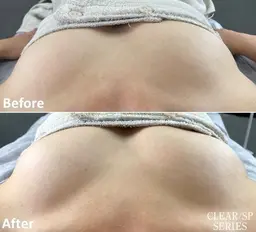 光バストアップ✨バストのコンディションを整えバスト水々しくふっくらとしたバストに仕上がります！