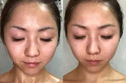 フェイスラインくっきり！小顔フェイシャル💆‍♀️