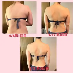 痩身エステ（全身）　足　背中　お腹　腕　肩　の全身痩身エステ　期間限定プライス