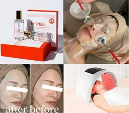 「ツヤ水光肌」ハイドラ毛穴洗浄+ララピール+筋膜リリース+LED光フェシャル（ララピール専用パック付き）70分