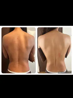 ダイエットの味方！痩身リンパトリートメント60分