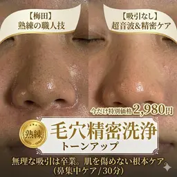 【肌質改善 毛穴洗浄】無理な吸引は卒業✨ベテランの超音波＆精密ケア ¥2,980（大阪 梅田）