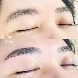 ハリウッドブロウリフト