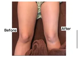 【痛くない】Style Me.の痩身エステ整体