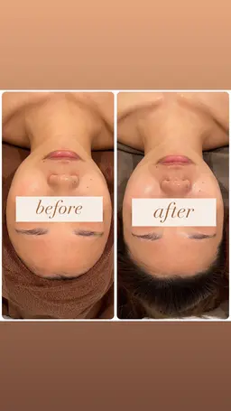 【小顔×毛穴🌿】小顔＋毛穴洗浄🧖🏻‍♀️ ◎毛穴詰まりや皮脂でざらつきを感じる方にオススメ！