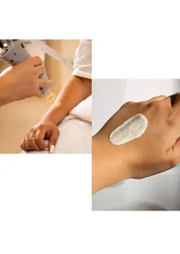 minimo限定⭐ピーリング+脱毛SET両手の甲✋：同時施術で相乗効果♪見えるところの集中ケアセット👶