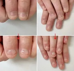 【ネイルNG職場も◎】目立たず自然な自爪風✨深爪補正+クリア仕上げ(マットも可)