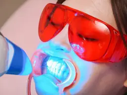 🙋‍♀️大人気‼️🦷日時限定【歯科医師監修ホワイトニング】⭐️注意事項お読みください