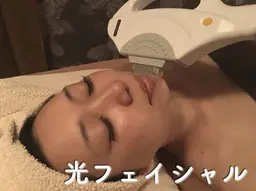 お試し光フェイシャル