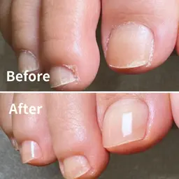 🌟フットケア🌟