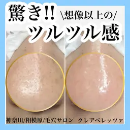 毛穴ケアすっきりメニュー⭐️長年の毛穴の黒ずみが気になる方におすすめ⭐️